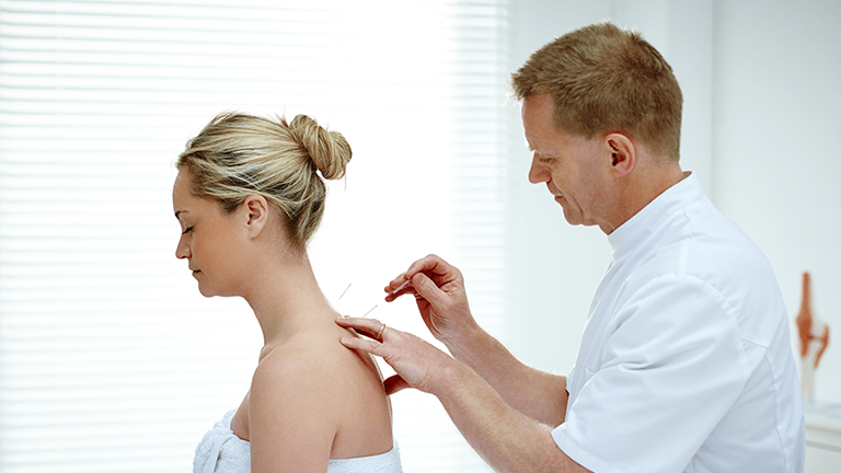 Accupuncturist doing acupuncture on the back of a female patient.